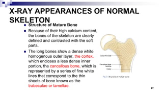 Radiological anatomy | PPTX