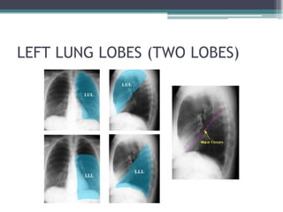 RADIOLOGICAL ANATOMY AND PATHOLOGY OF THORAX.pdf
