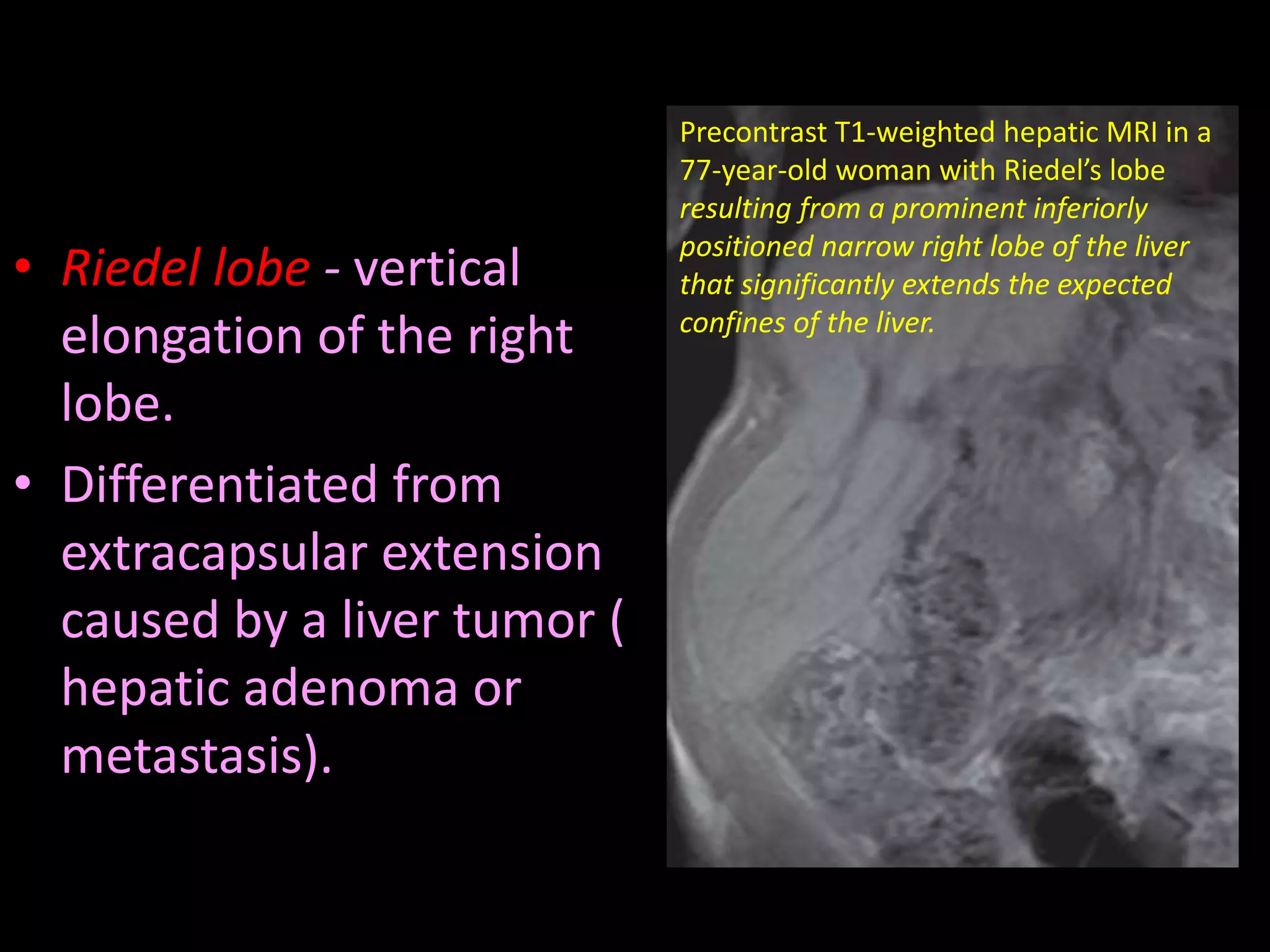 Radiological anatomy of_abdomen[1] | PPTX