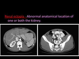 Radiological anatomy of_abdomen[1] | PPTX