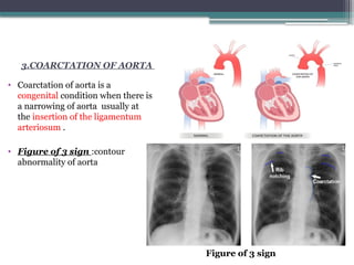 Comprehensive Radiological Anatomy of the Aorta and Its Branches with ...