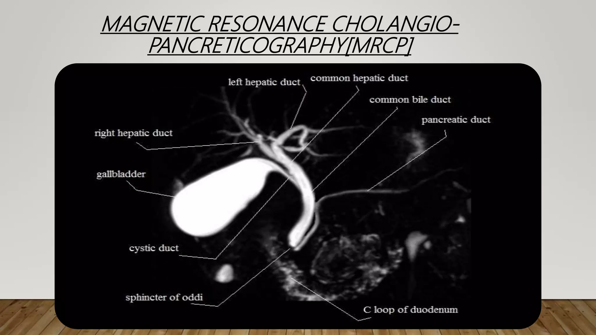 Radiological anatomy of biliary system | PPTX