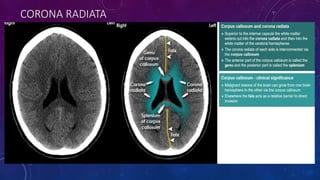 RADIOLOGICAL ANATOMY OF BRAIN.pptx………….. | PPTX
