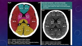 RADIOLOGICAL ANATOMY OF BRAIN.pptx………….. | PPTX
