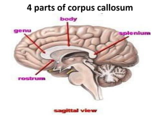 CT and MRI anatomy of brain | PDF