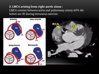 Lmca Block Radiological anatomy of coronary artery and its variations copy copy.pptx