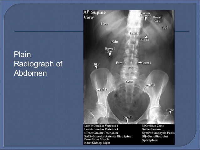 Radiological Anatomy Of Kidney Ureter Bladder