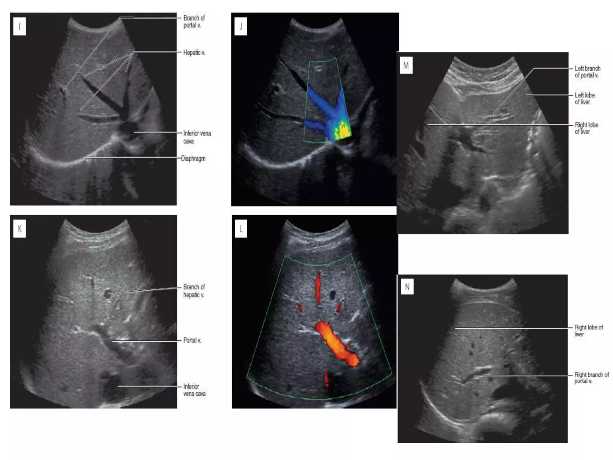 Segmental Anatomy of Liver and its Radiological Correlation | PPTX