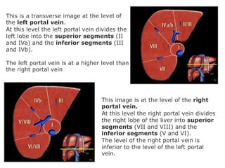 Segment Inferior Segmental Anatomy of Liver and its Radiological Correlation | PPTX