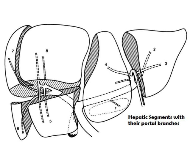 Segmental Anatomy of Liver and its Radiological Correlation | PPTX ...