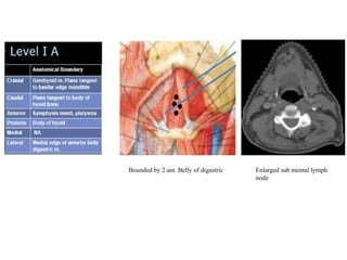 Radiological anatomy of lymph node