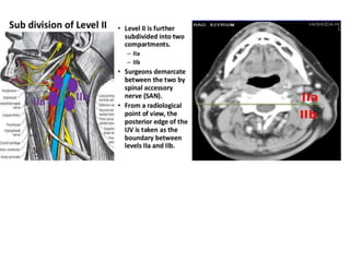 Radiological anatomy of lymph node