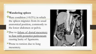 Radiological anatomy of Pancreas and Spleen | PPTX