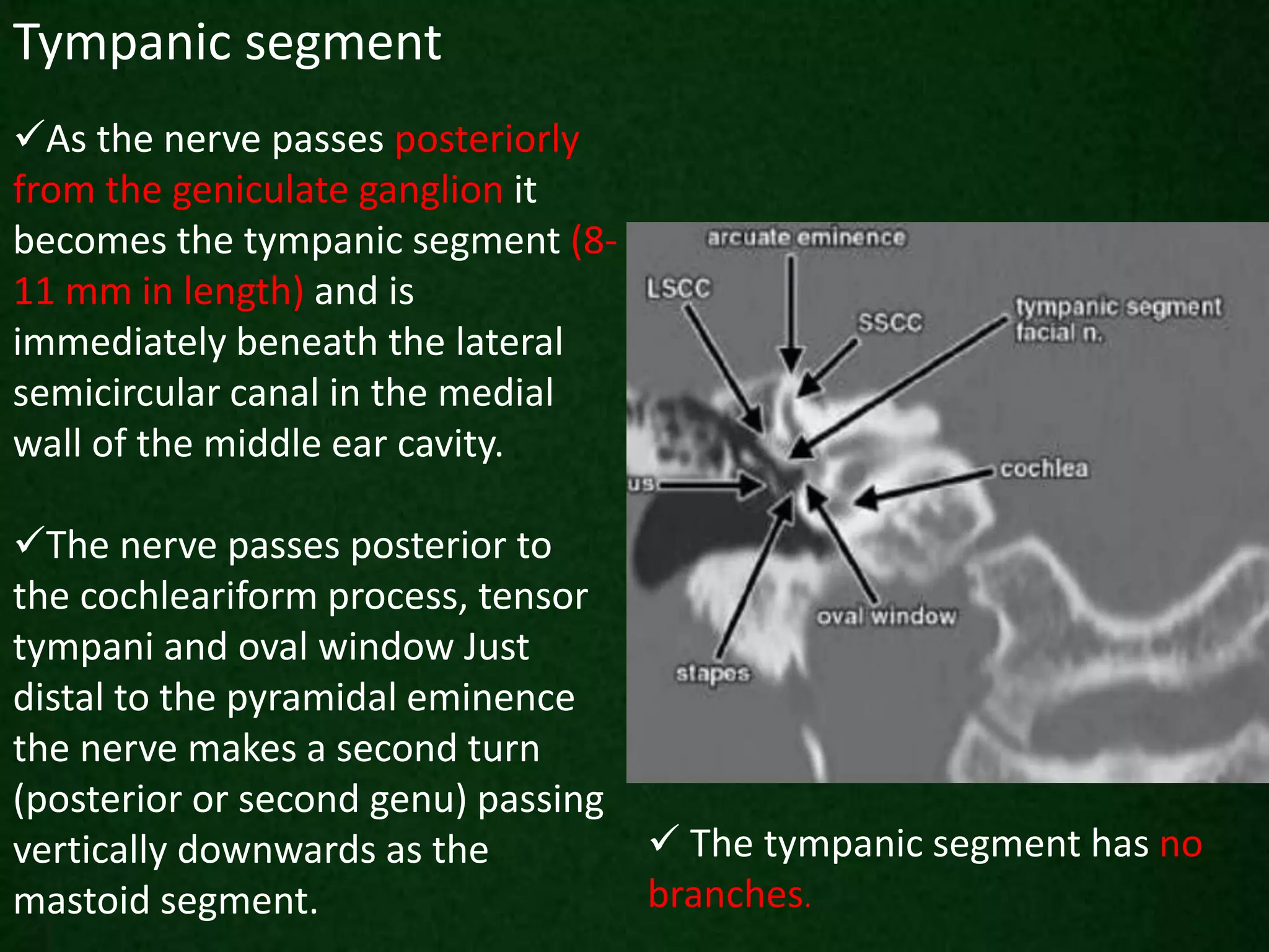 Tympanic segment
As the nerve passes posteriorly
from the geniculate ganglion it
becomes the tympanic segment (8-
11 mm in length) and is
immediately beneath the lateral
semicircular canal in the medial
wall of the middle ear cavity.
The nerve passes posterior to
the cochleariform process, tensor
tympani and oval window Just
distal to the pyramidal eminence
the nerve makes a second turn
(posterior or second genu) passing
vertically downwards as the
mastoid segment.
 The tympanic segment has no
branches.
 
