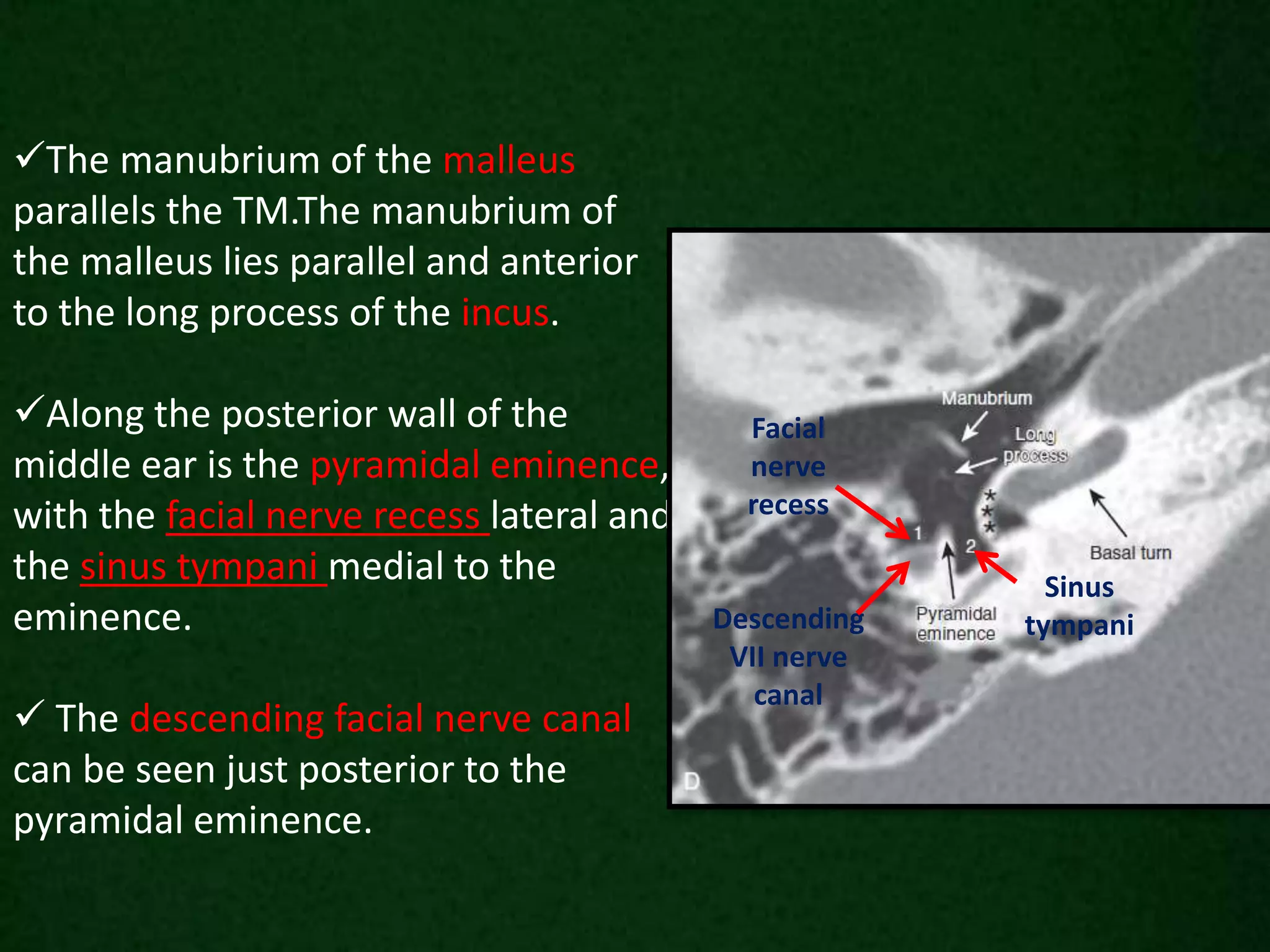 The manubrium of the malleus
parallels the TM.The manubrium of
the malleus lies parallel and anterior
to the long process of the incus.
Along the posterior wall of the
middle ear is the pyramidal eminence,
with the facial nerve recess lateral and
the sinus tympani medial to the
eminence.
 The descending facial nerve canal
can be seen just posterior to the
pyramidal eminence.
Facial
nerve
recess
Sinus
tympaniDescending
VII nerve
canal
 