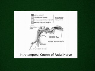 Radiological anatomy of_temporal_bone[1] | PPTX