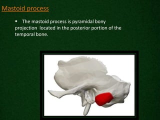 Radiological anatomy of_temporal_bone[1] | PPTX