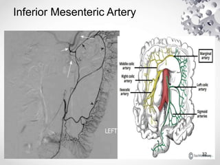 Radiological anatomy of the abdominal aorta | PPTX