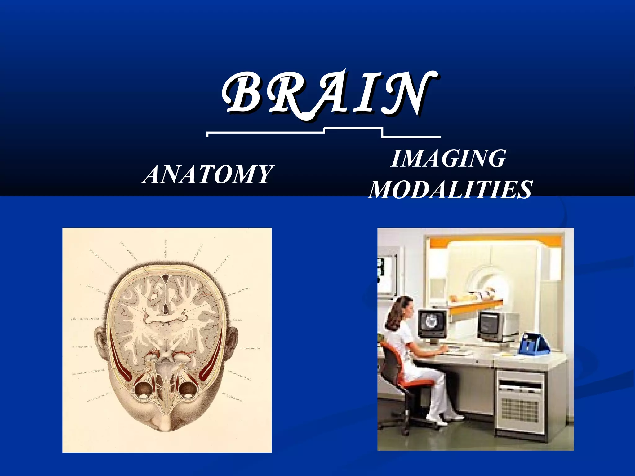 Radiological anatomy of the brain | PPT