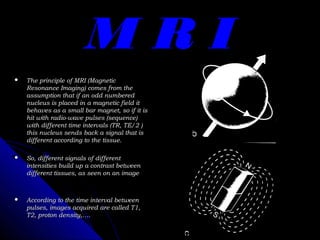 Mri Math Radiological anatomy of the brain | PPT