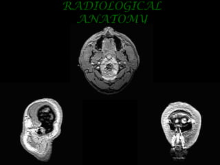 Radiological anatomy of the brain | PPT