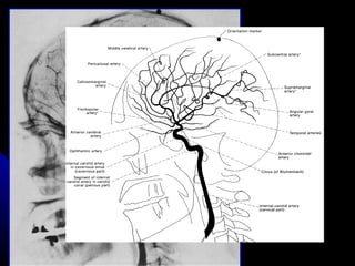 Radiological anatomy of the brain | PPT
