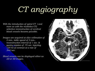Ct Brain Collimation Radiological anatomy of the brain | PPT