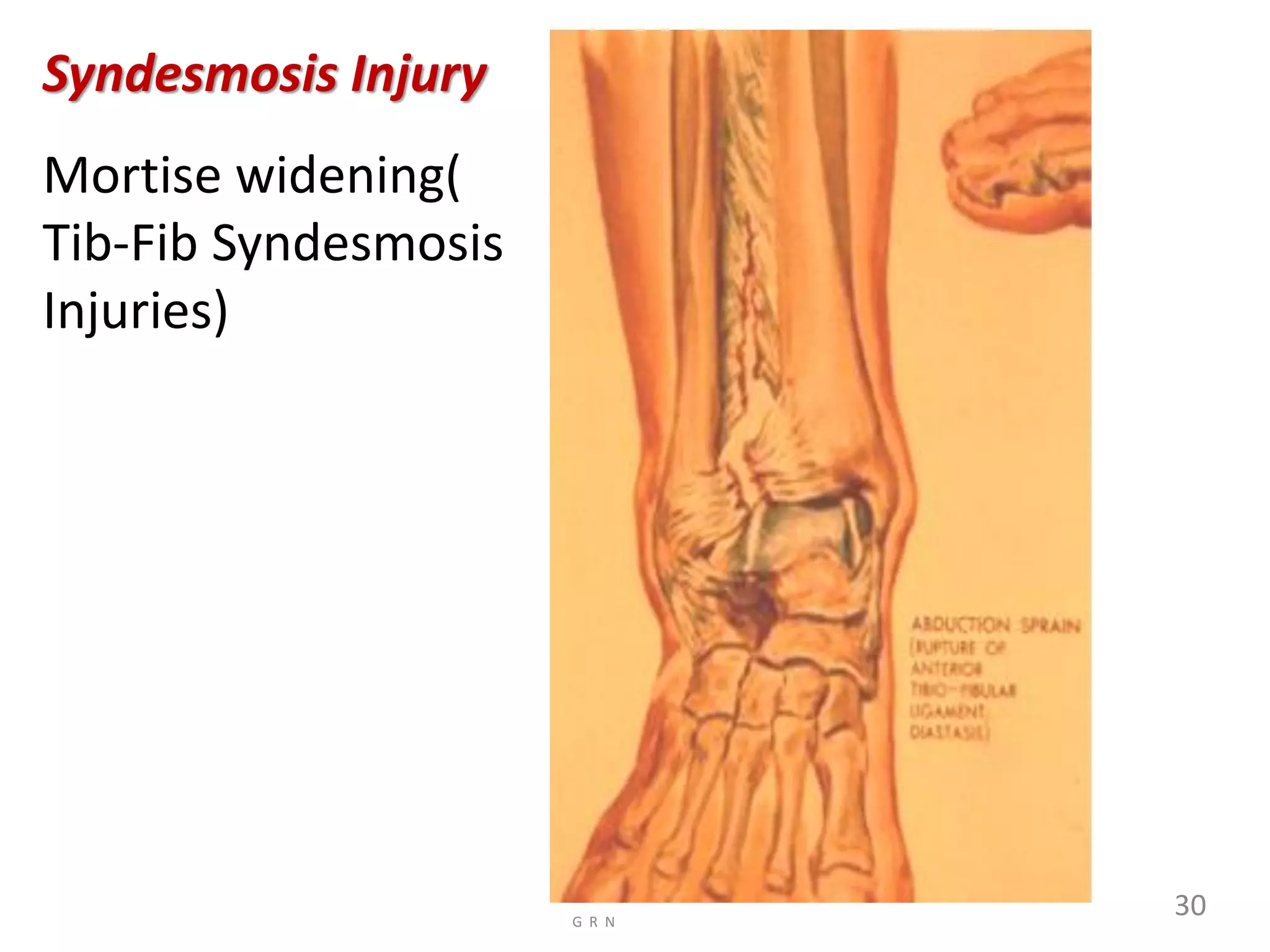 Radiological anatomy of the lower limb r | PDF