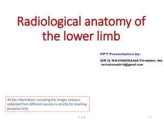 Radiological anatomy of
the lower limb
All the information, including the images and pics
collected from different sources is strictly for teaching
purposes only.
G R N 1
 