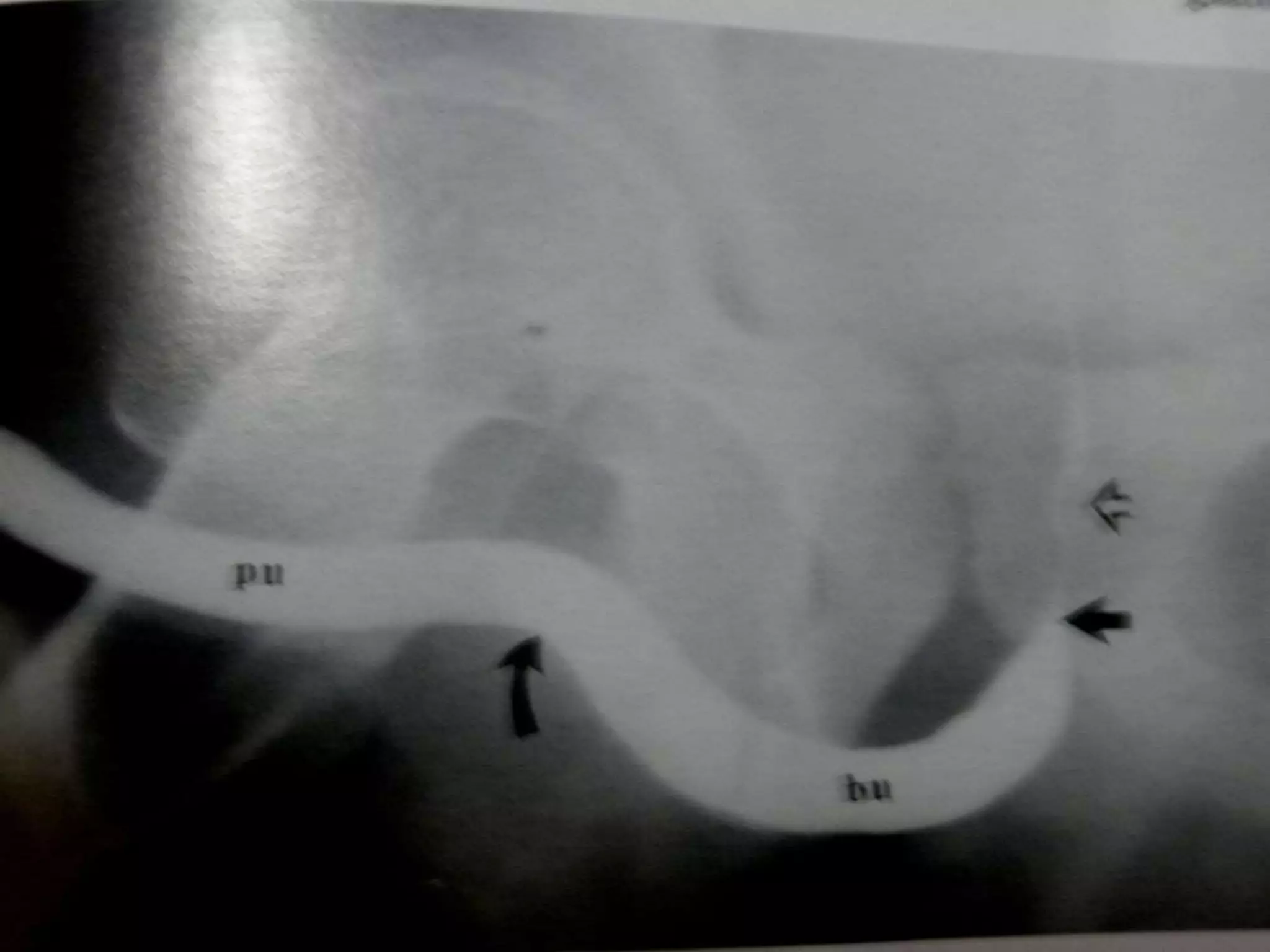 Radiological anatomy of the male urethra and techniques of imaging | PPTX