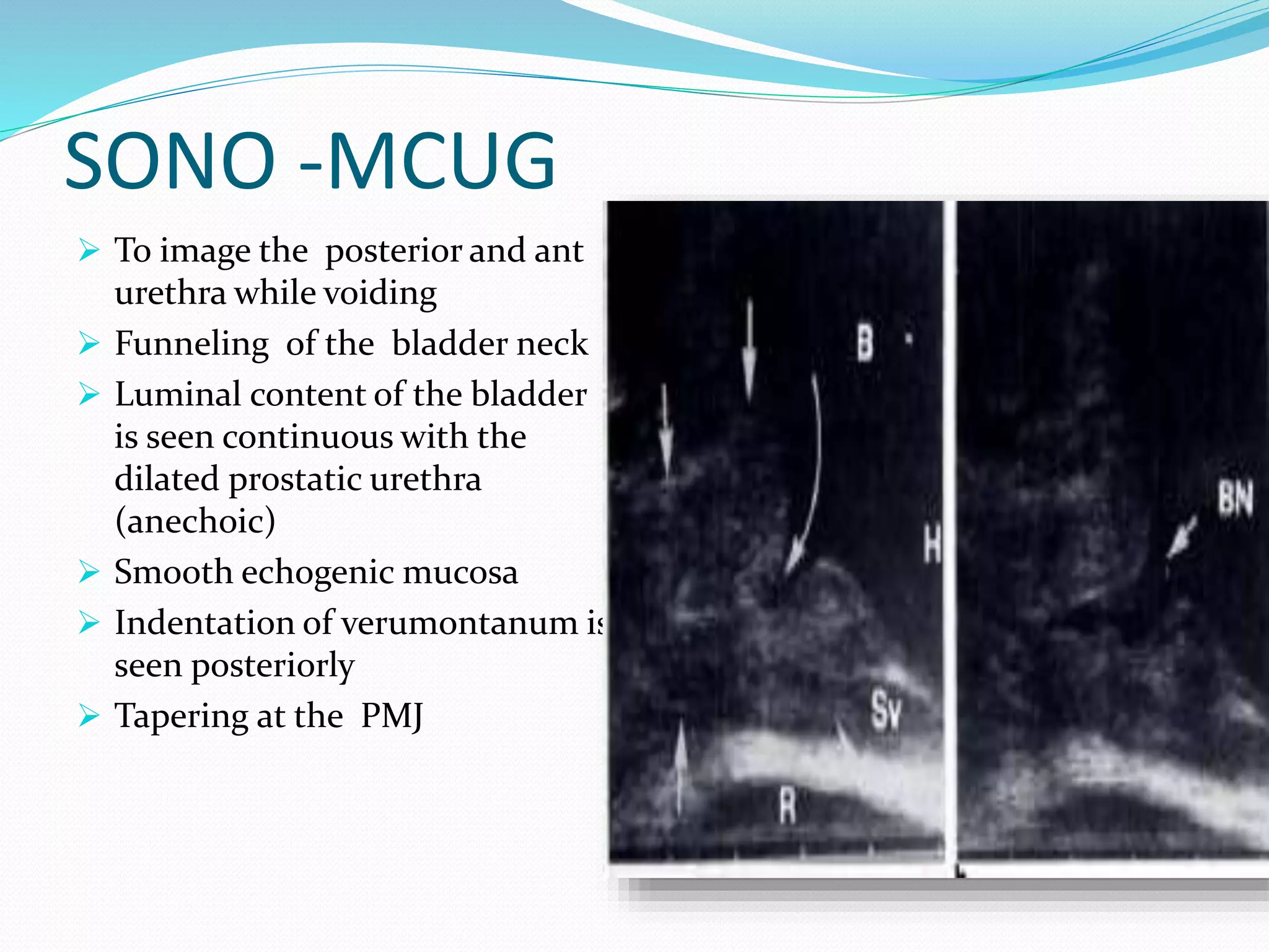 Radiological anatomy of the male urethra and techniques of imaging | PPTX