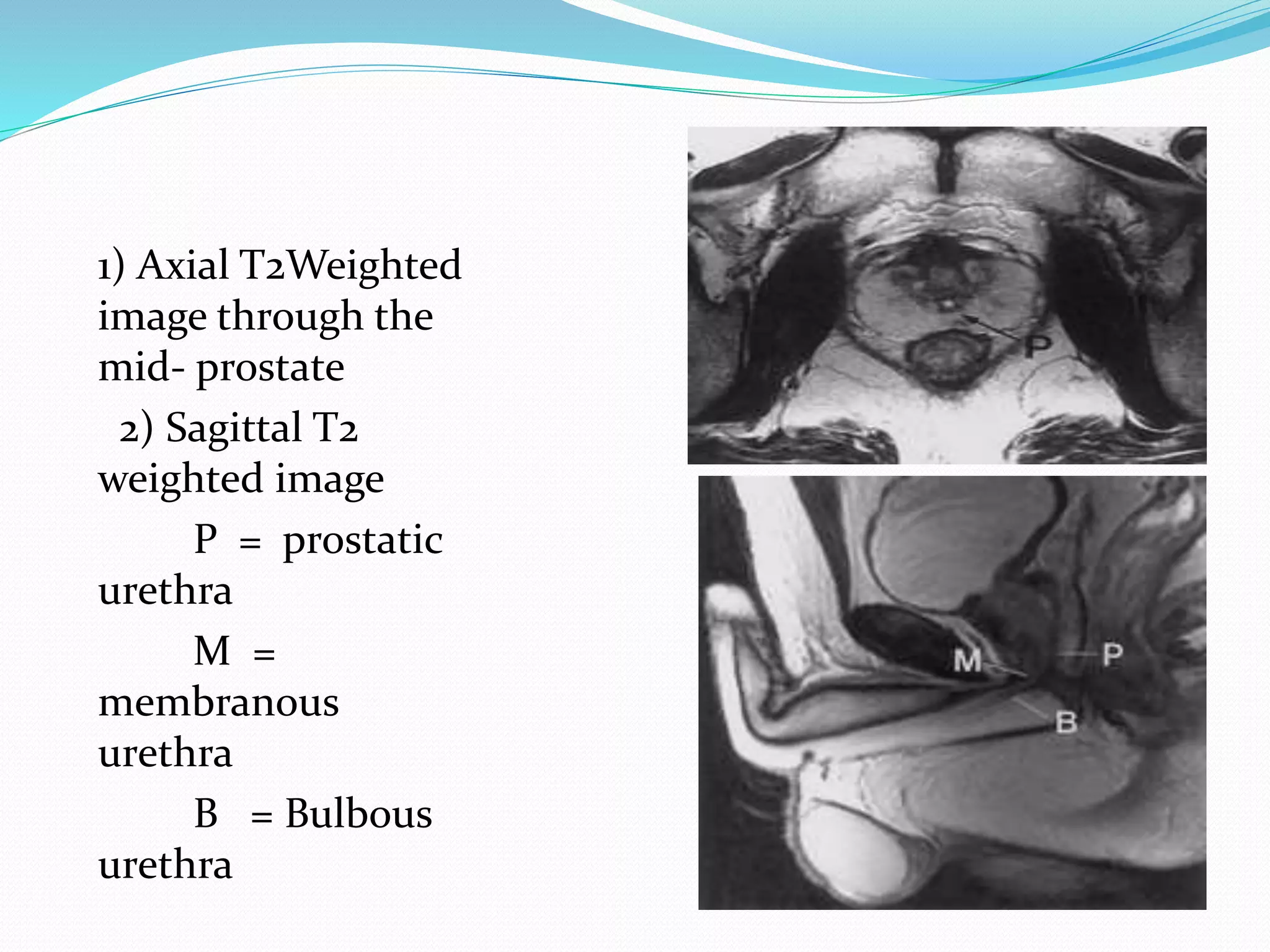 Radiological anatomy of the male urethra and techniques of imaging | PPTX