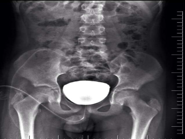 Radiological anatomy of the male urethra and techniques of imaging ...