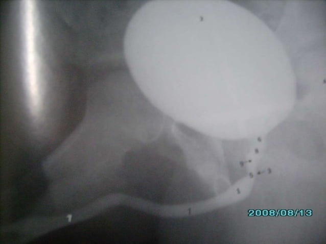 Radiological anatomy of the male urethra and techniques of imaging ...