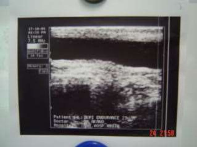 Radiological anatomy of the male urethra and techniques of imaging ...