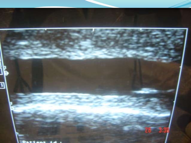 Radiological anatomy of the male urethra and techniques of imaging ...