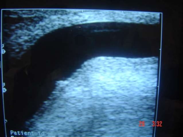 Radiological anatomy of the male urethra and techniques of imaging ...