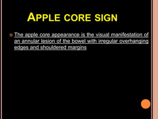 Radiology ----Classical Signs in GIT Dr. Muhammad Bin Zulfiqar | PPT