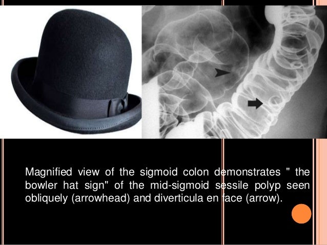 bowel hat