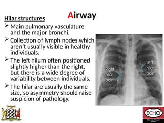 Radiological_diagnosis_of_TB_ECHO_MOH[1].pptx