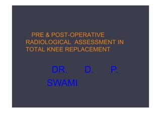 PRE & POST-OPERATIVE
RADIOLOGICAL ASSESSMENT IN
TOTAL KNEE REPLACEMENT
DR. D. P.
SWAMI
 