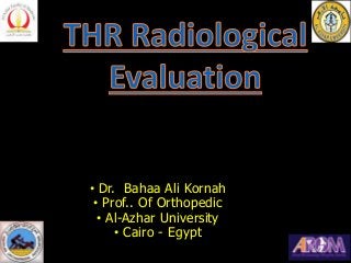 • Dr. Bahaa Ali Kornah
• Prof.. Of Orthopedic
• Al-Azhar University
• Cairo - Egypt
 