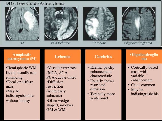 Radiological features of intracranial tumors 1