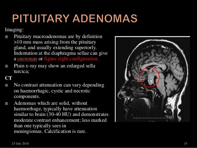Herbal supplements for brain function picture 4