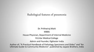 Radiological features of pneumonia
Dr. Prithwiraj Maiti
MBBS
House Physician, Department of Internal Medicine
R.G.Kar Medical College
Admin and Founder, Pgblaster India
Author of: “A Practical Handbook of Pathology Specimens and Slides” and “An
Ultimate Guide to Community Medicine”; published by Jaypee Brothers, India
 