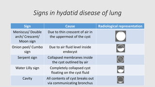 Radiological features of pneumonia | PPTX