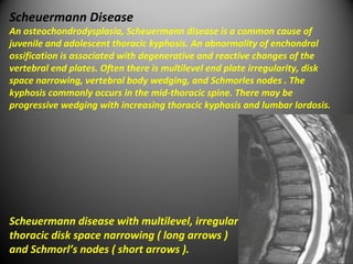 Radiological findings of congenital anomalies of the spine and spinal ...