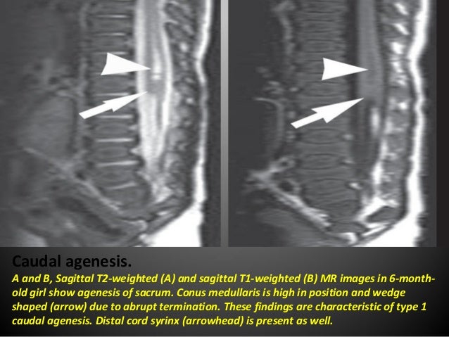 Radiological findings of congenital anomalies of the spine ... terminal block schematic 