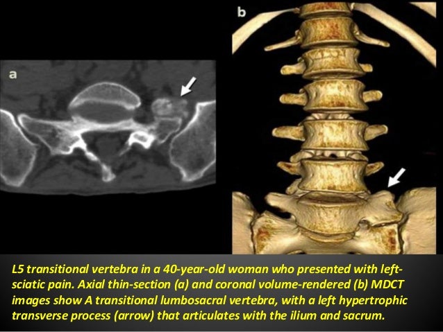 Radiological findings of congenital anomalies of the spine and spinal…