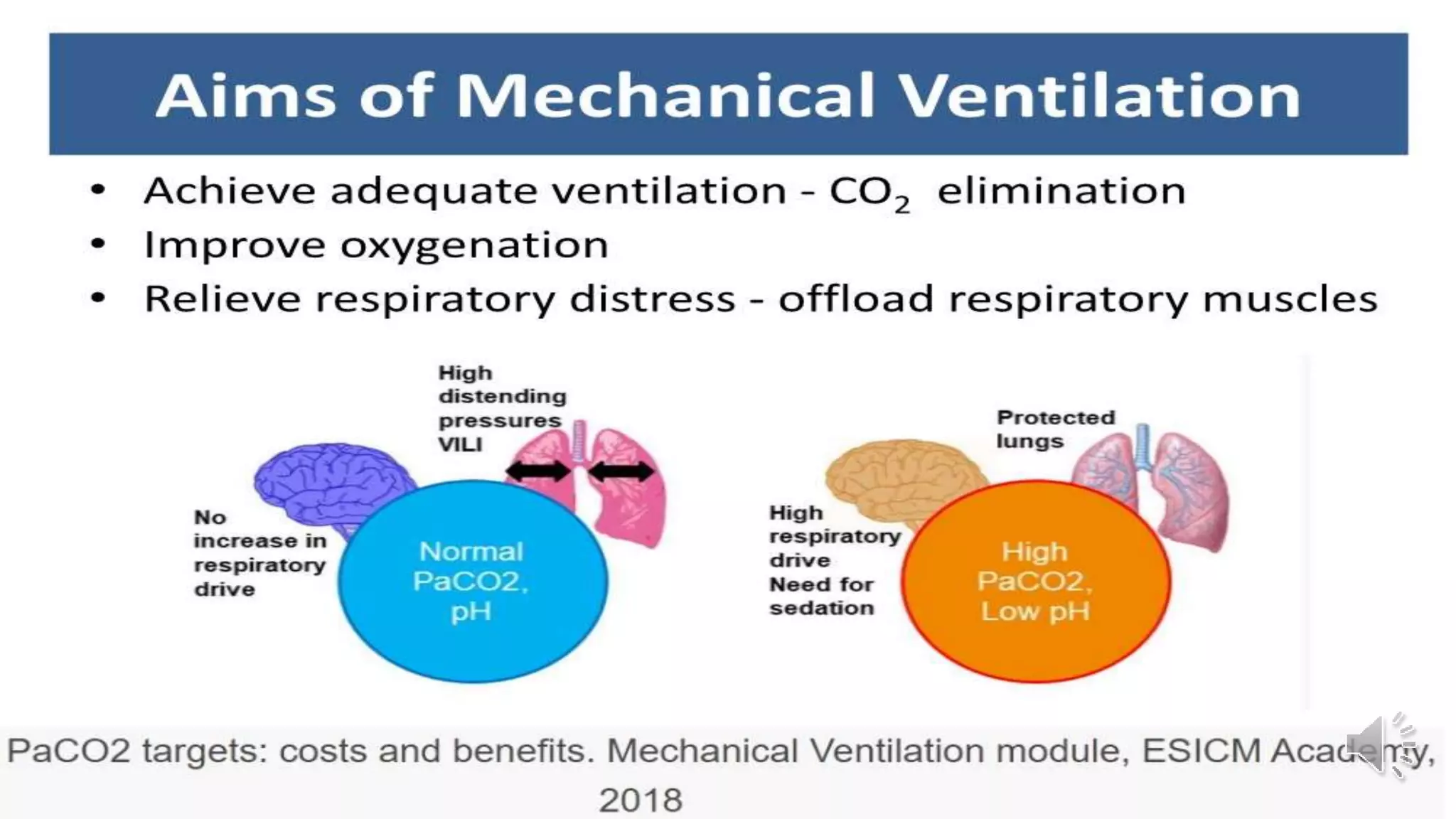 Radiological Presentation of COVID 19